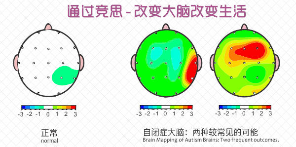 自閉癥訓練方案